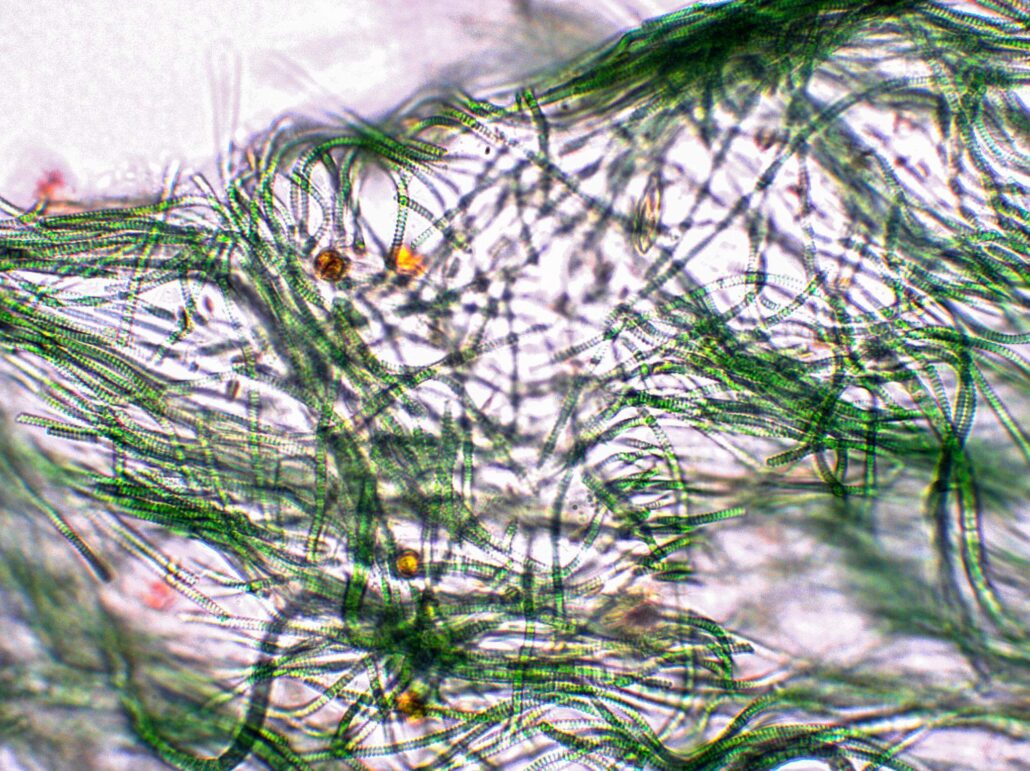 spirulina mikroalga mikroszkópos képe